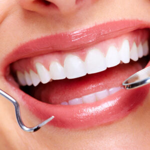 Teeth Whitening Treatment