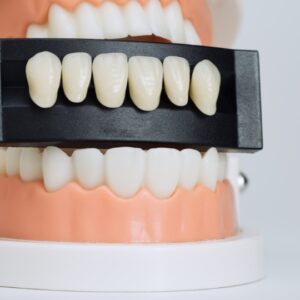 dental veneers cost