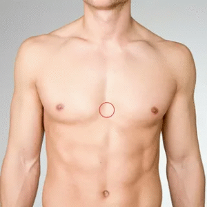Gynaecomastia Surgery in Dubai