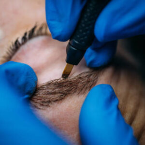 Is Eyebrow Hair Transplant Safe and Effective