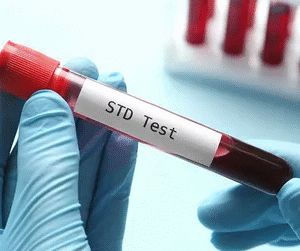 STD Test in Dubai