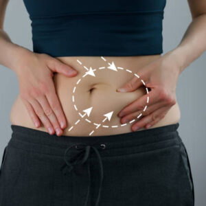 Tummy Tuck in Riyadh