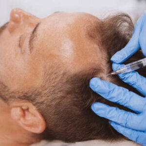What Are Hair Fillers and Do They Really Add Fullness?