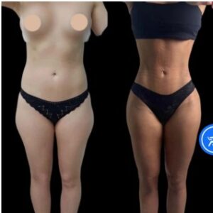 Best Plastic Surgeons in Dubai for Personalized Cosmetic Cares