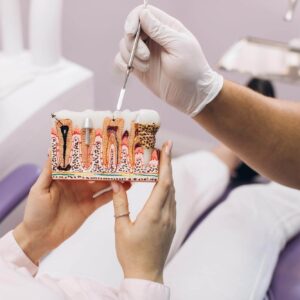 Root Canal in Anchorage, AK