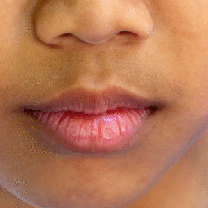  Dark Spots on Lips: Causes, Treatments, and Prevention